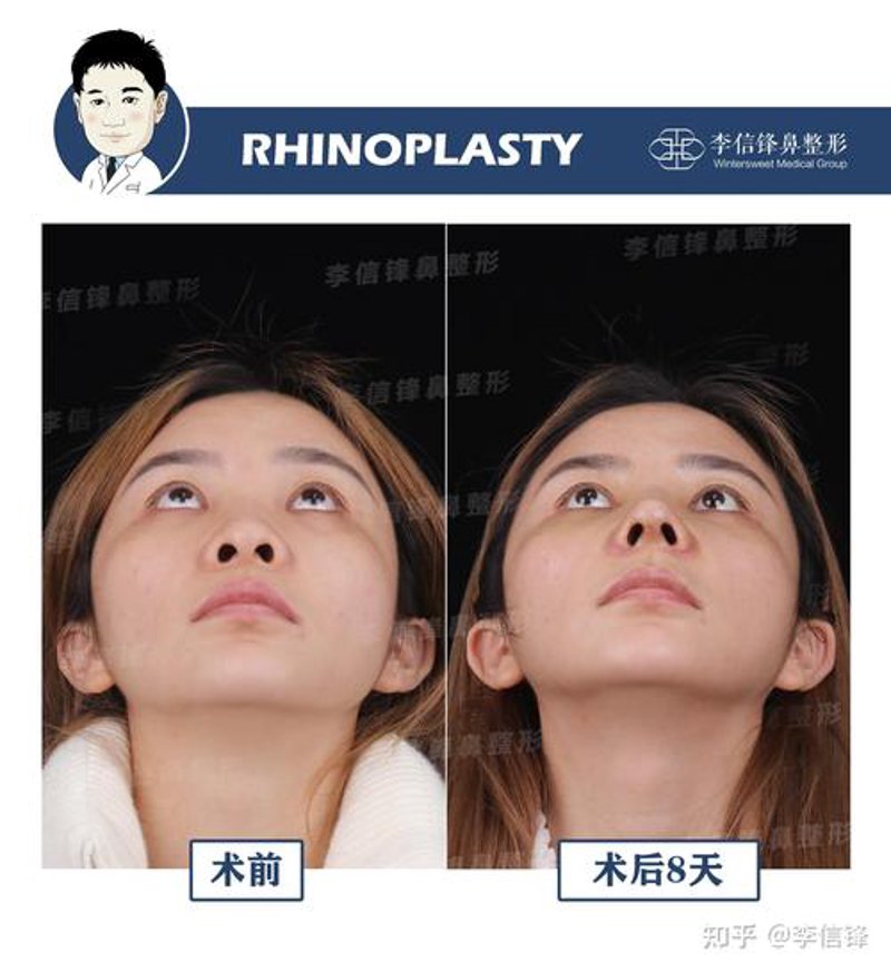 长春美容医院选择指南：美丽从这里开始