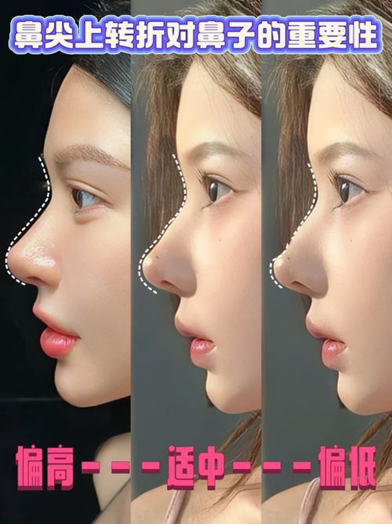 如何通过护肤技巧展现你的美丽